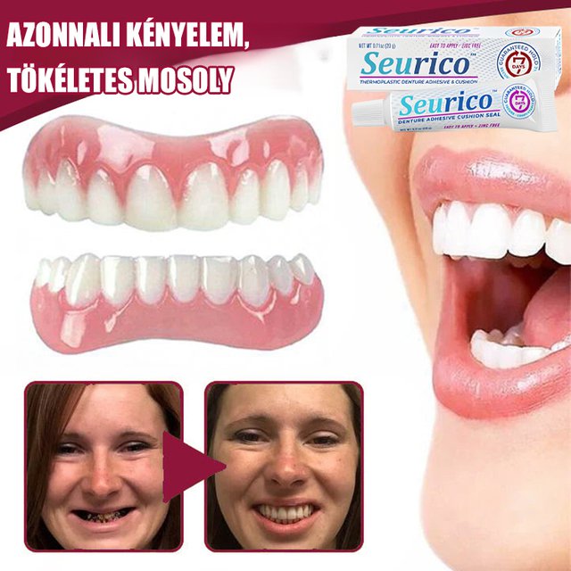 【Élelmiszeripari】hőre lágyuló műanyag műfogsorragasztó