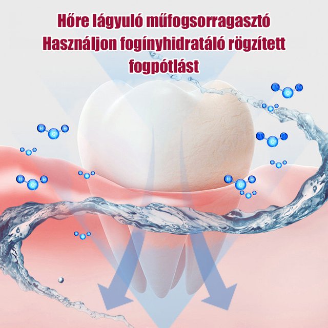 【Élelmiszeripari】hőre lágyuló műanyag műfogsorragasztó
