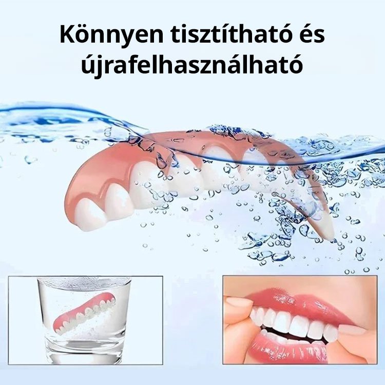 Tökéletes Mosoly Fogpótlás Készlet